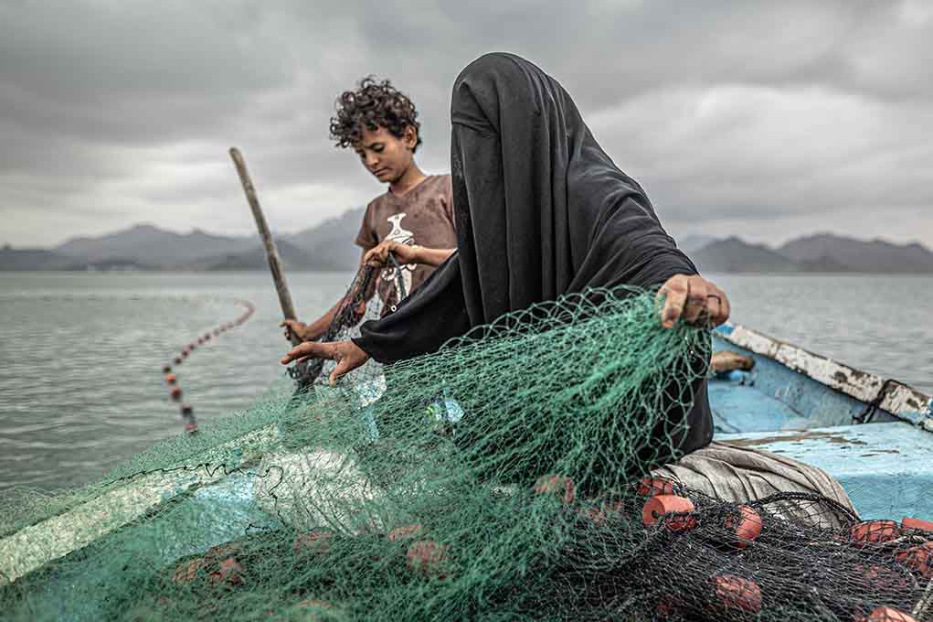 World Press Photo - Yemen Hunger Another War Wound