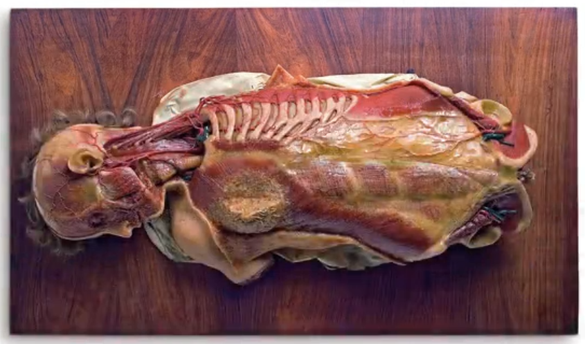 Tavola III Testa e tronco di giovinetta con preparazione di muscoli e vasi (Fonte: Università degli Studi di Cagliari)