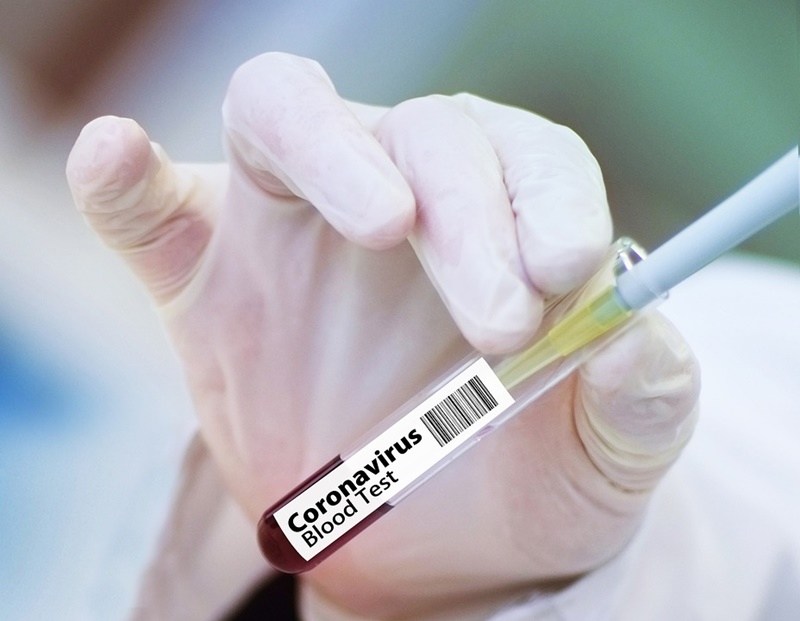 Vaccino anti Covid - la mano dell'infermiere con Vaccino Covid