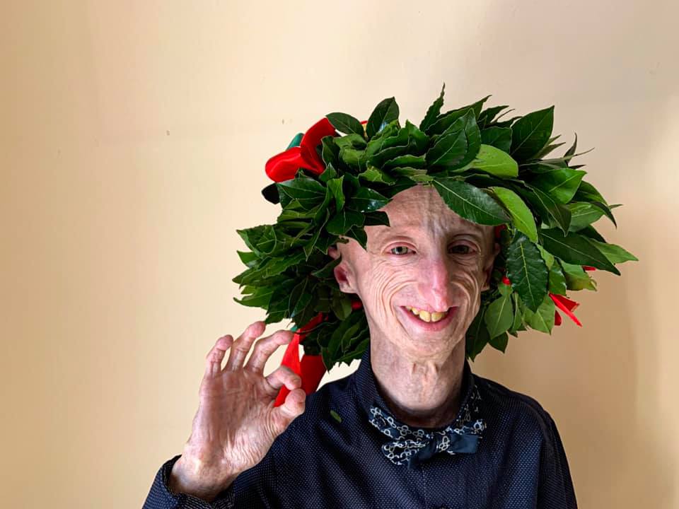 Sammy Basso - Sammy dopo la laurea